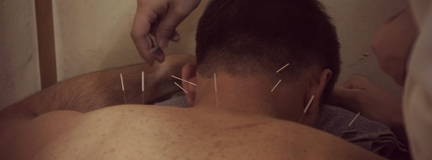 acupuncture color